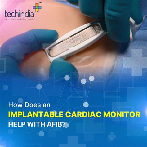 water bottle test heart monitor|what does a heart monitor mean.